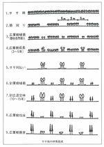 イメージ（ササ地の林帯造成）